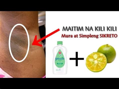 Home Remedy For Kulani Sa Kilikili .